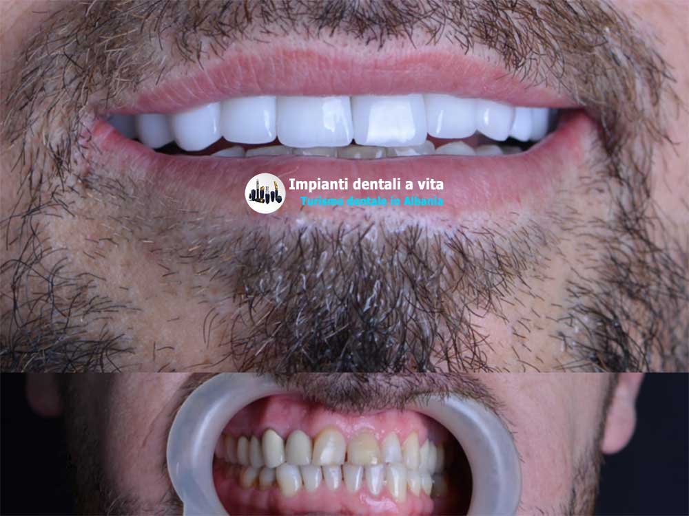 contatti-impianti-dentali