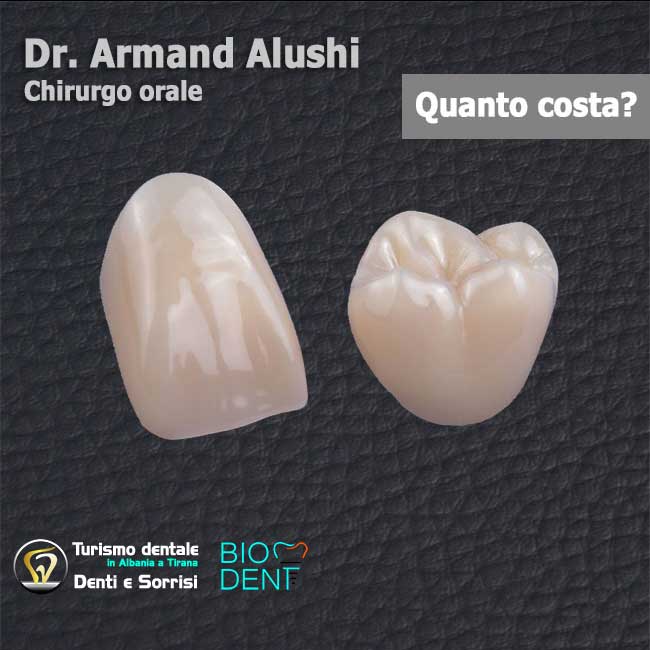 Dentista-in-Albania-con-clinica-dentale-a-Tirana-per-turismo-dentale-denti-corone-capsule-singole-in-zirconio
