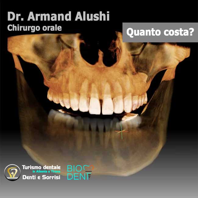 Dentista-in-Albania-con-clinica-dentale-a-Tirana-per-turismo-dentale-Esame-tac-3d-per-l'implantologia-e-chirurgia