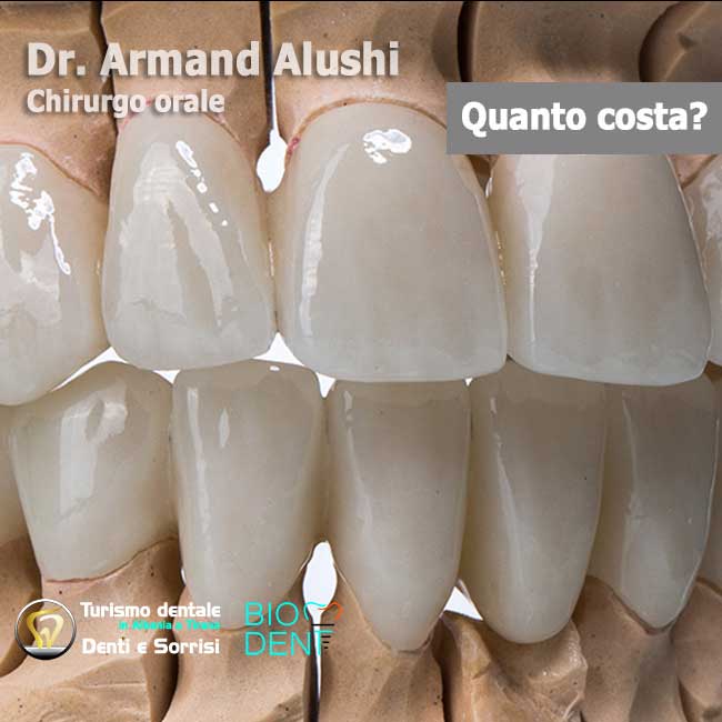 Dentista-in-Albania-con-clinica-dentale-a-Tirana-per-turismo-dentale-denti-corone-in-zirconio-per-estetica-dentale