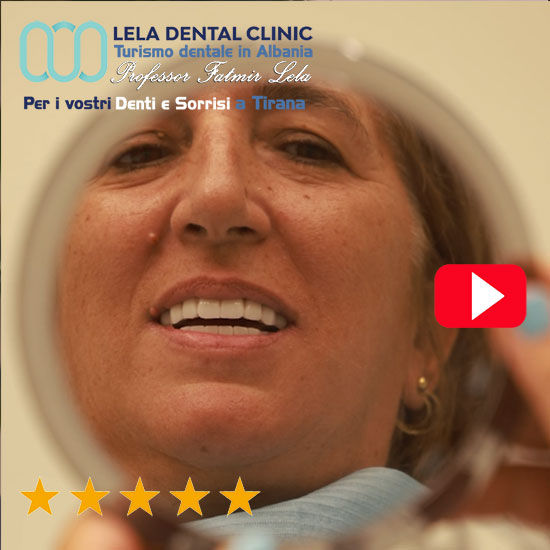 recensione-Carla-Lela-dental