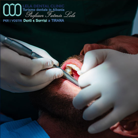 26-Clinica-Lela-dental-del-professor-Fatmir-Lela